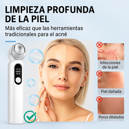 Limpiador de poros faciales HD Visual para el hogar con cámara 3 modos de ajuste para limpieza profunda Removedor de espinillas al vacío