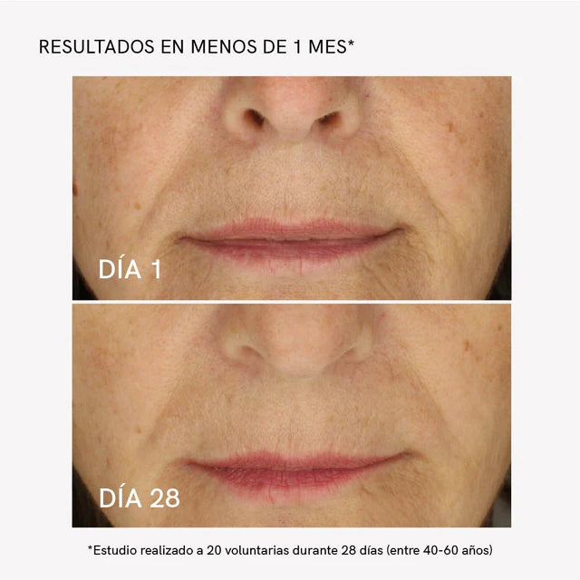Tratamiento Flacidez Facial