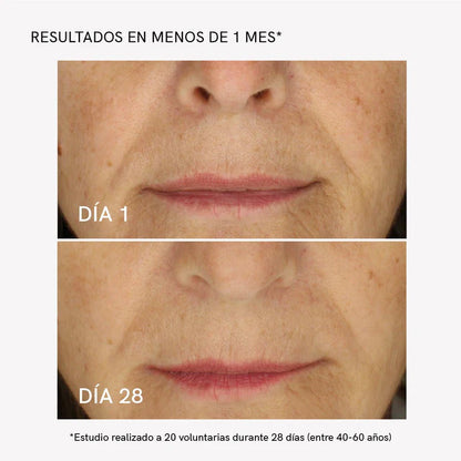 Tratamiento Flacidez Facial